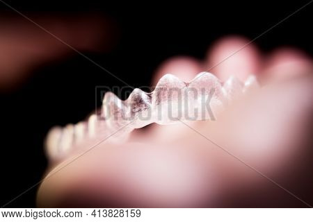 Transparent Ferule Retainer Teeth Alignment. Copy Space