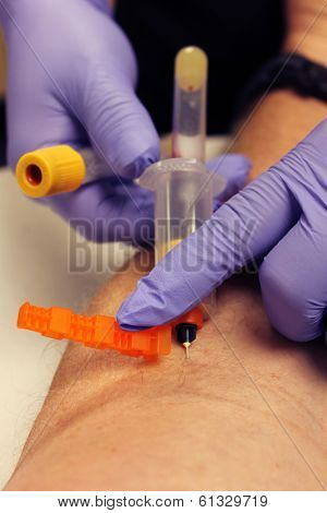 Genuine photos of a Phlebotomist aka Nurse, Doctor, or Trained Medical Professional taking Real Blood samples for analysis from a patient. Photos taken by the Patient while its happening.  