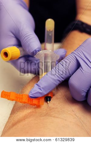 Genuine photos of a Phlebotomist aka Nurse, Doctor, or Trained Medical Professional taking Real Blood samples for analysis from a patient. Photos taken by the Patient while its happening.  