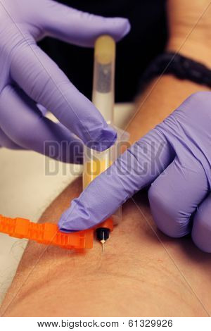 Genuine photos of a Phlebotomist aka Nurse, Doctor, or Trained Medical Professional taking Real Blood samples for analysis from a patient. Photos taken by the Patient while its happening.  
