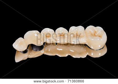 Dental Ceramic Bridge