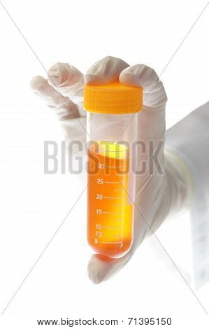Hand Holding Liquid Sample - Urine