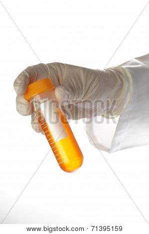 Hand Holding Liquid Sample - Urine