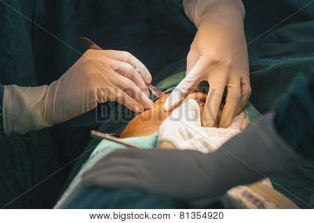 Surgeon Prepare For Skin Incision