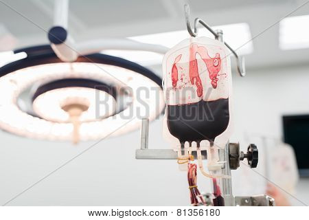 Giving Packed Red Cell Blood During Surgery
