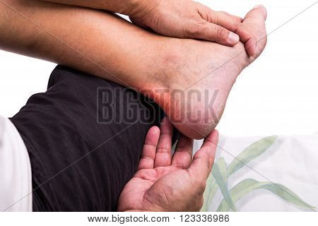 Man With Painful Inflammation At Back Of Foot