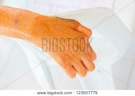 closeup hand of old man suffering from leprosy on the backrest of plastic chair.
** Note: Soft Focus at 100%, best at smaller sizes