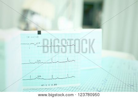ECG on the doctors table with medical documentation