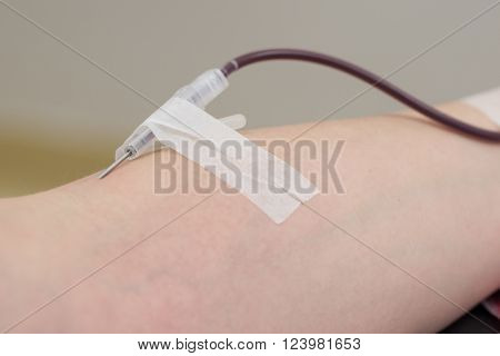 Donor In An Armchair Donates Blood,, Close-up