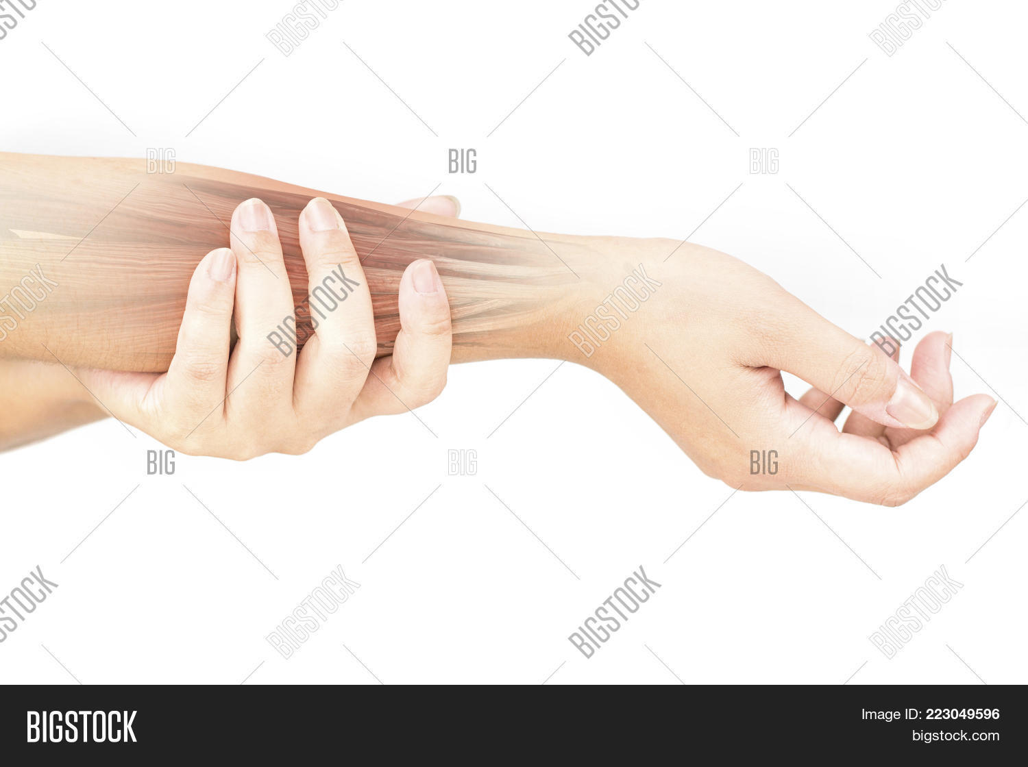 Forearm Muscle Pain Image & Photo (Free Trial) Bigstock