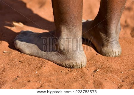 Kalahari Desert bushman woman with cracked heels
