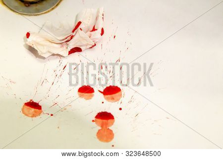Real Drops Of Blood Fallen On A Sink Along With Napking In Attempt To Stop It. Background For Usage 