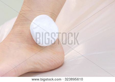 Surgeon Puts Cotton Pads On Patients Leg With Suture Sfter Ankle Hygroma Removal, Closeup View. Reco