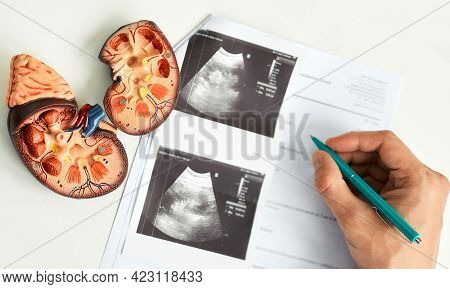 Kidney Ultrasound. Doctor Analyzing Of Patient Kidney Health Using Kidney Ultrasound