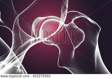 Canine dysplasia, dog bone with visible hip joint and femur affected by inflammation due to dysplasia, 3d illustration