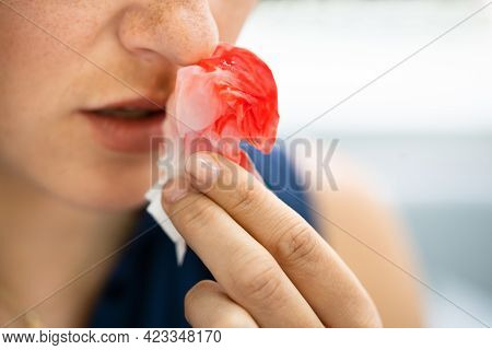 Woman Trying To Stop Blood Bleeding From Nose