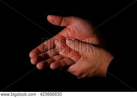 One Hand Gripping The Other Tightly To Ease The Pain. Post Covid Syndrome Concept.