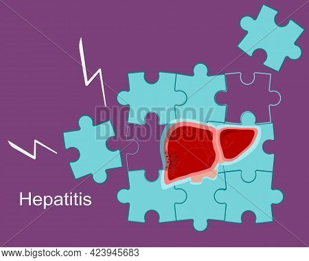 Concept Of Hepatitis A,b,c,d, Cirrhosis.fragile And Broken Liver Falls Apart By Puzzles.world Hepati
