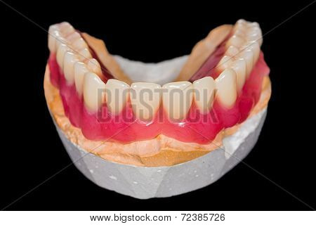 Lower Denture