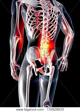 Anatomy - Back Pain.