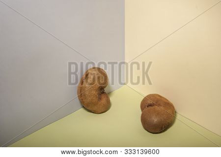 Kiwi Fruits, Similar To The Kidneys. Kidney Health Concept. Promotional Photo Concept Of Kidney Dise