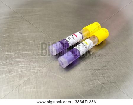 Low Temperature Sterilization Biological Indicator Before And After Exposure Of Sterilization