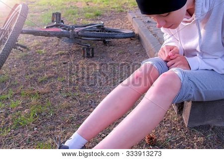 Woman Blowing On Pain Abrasion Knees After Falling Of Bicycle On Nature Sitting On Ground. Wound, Ab
