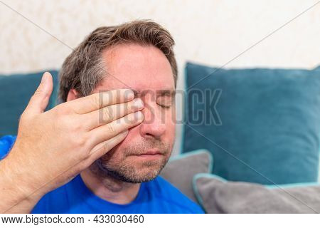 Middle Aged 45s Man Holding Hand Over His Aching Eye At Home On The Couch.closeup.