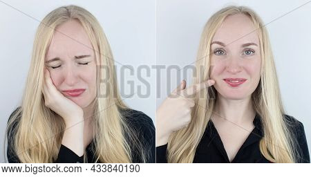 Before And After. On The Left, The Woman Indicates Teeth Pain, And On The Right, Indicates That The