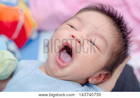 Little asian newborn with candidiasis on tongue