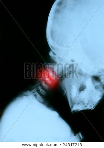 Kipu Neck