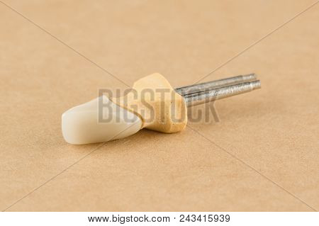 Cast And Cermet Dental Structures For Restoration Of Teeth