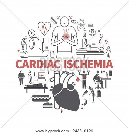 Cardiac Ischemia. Symptoms, Treatment. Line Icons Set. Vector Signs For Web Graphics