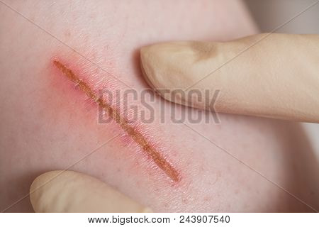 First Aid For A Girl, Close Up