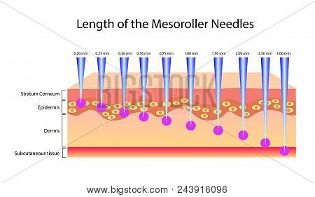 Length Of The Mesoroller Needles, Vector Illustration Isolated