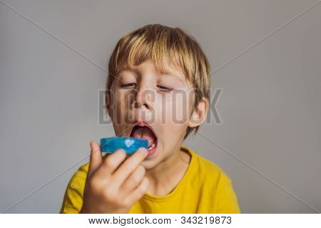 Six-year Old Boy Shows Myofunctional Trainer. Helps Equalize The Growing Teeth And Correct Bite, Dev