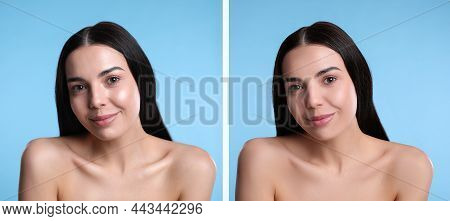 Collage With Photos Of Beautiful Young Woman Before And After Using Mattifying Wipes On Light Blue B