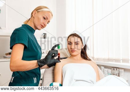 Plasmolifting. Beautician Shows A Tube With Blood To The Client. Preparation Of Blood For Rejuvenati