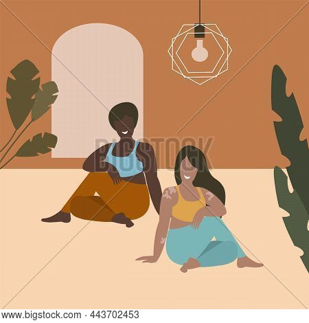Womans With Vitiligo. Body Positive, Self Love, Depigmentation Disease, Accepting Your Body.