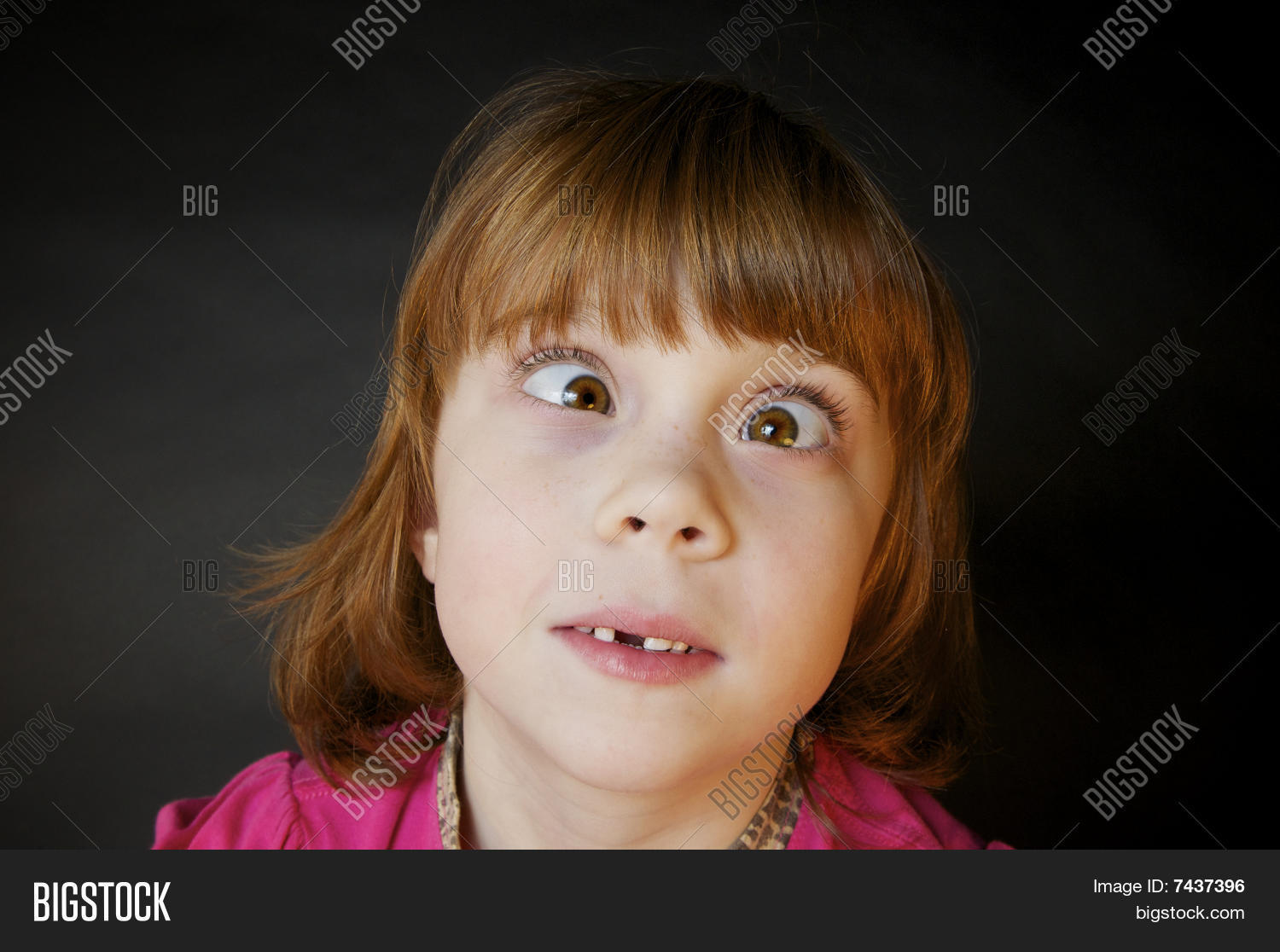 Cross Eyed Little Girl Red Hair Image & Photo Bigstock