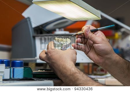 Production Dentures