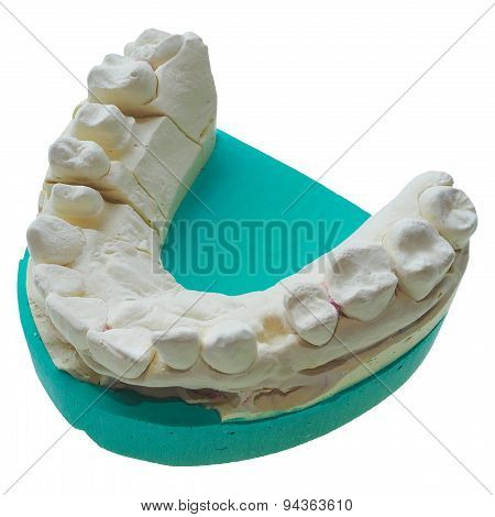 Positive Teeth Cast