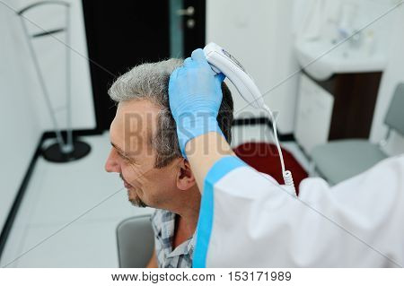 diagnostics hair and scalp. Trihoskopiya. Doctor examine patient male hair a special apparatus