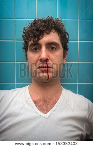 Curly haired man in bathroom with bad nose bleed