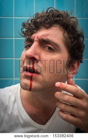 Curly haired man in bathroom with bad nose bleed