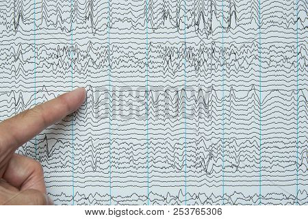 Index Finger Pointing At Imaging Of Human Brain Waves From Electroencephalography Or Eeg