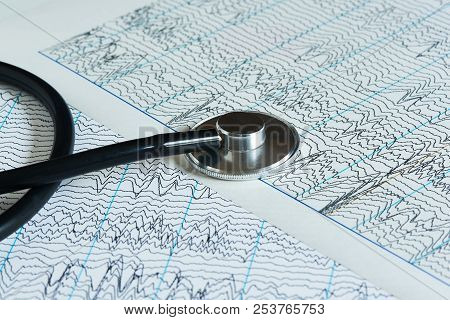 A Black Stethoscope On Background Of Two Brain Waves Or Eeg Papers