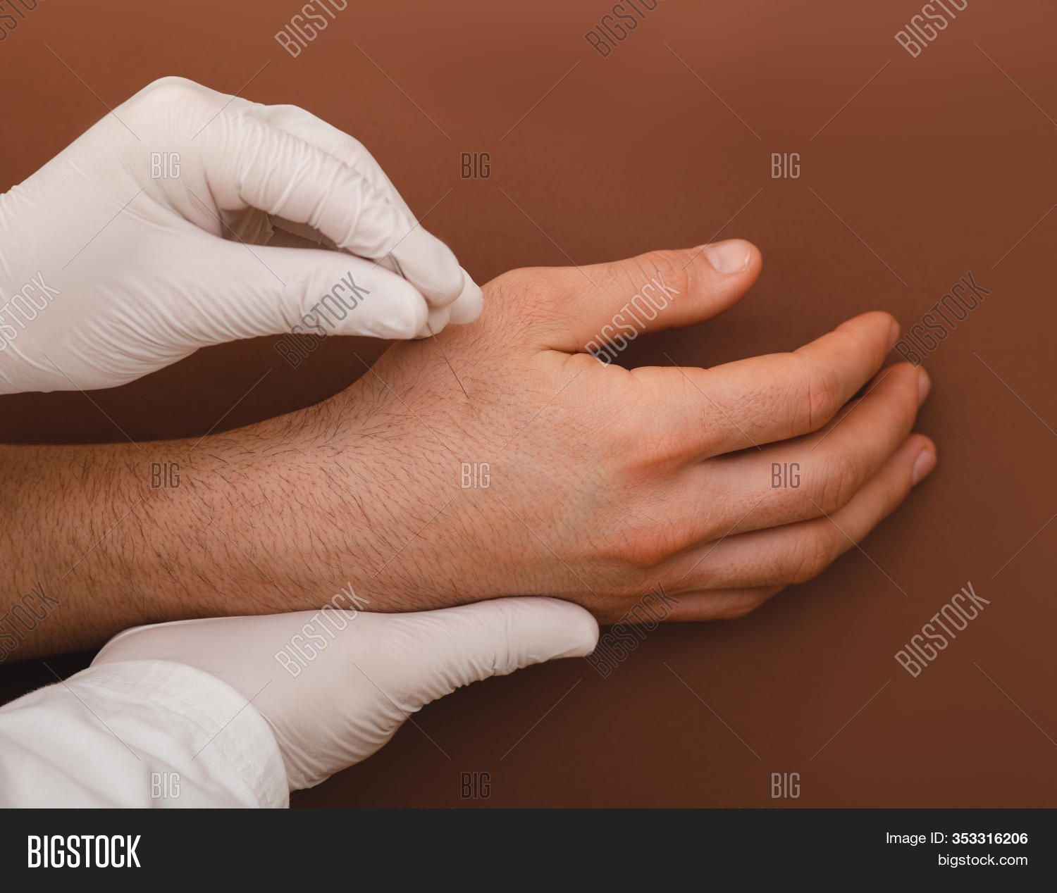 Acupuncturis Insert Image & Photo (Free Trial) Bigstock