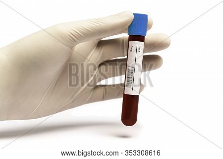 Hand Holding Vial With Blood On White Background