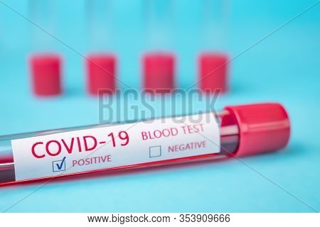 Test Tube With Blood Sample For Covid-19 Test, Novel Coronavirus 2019 Found In Wuhan, China